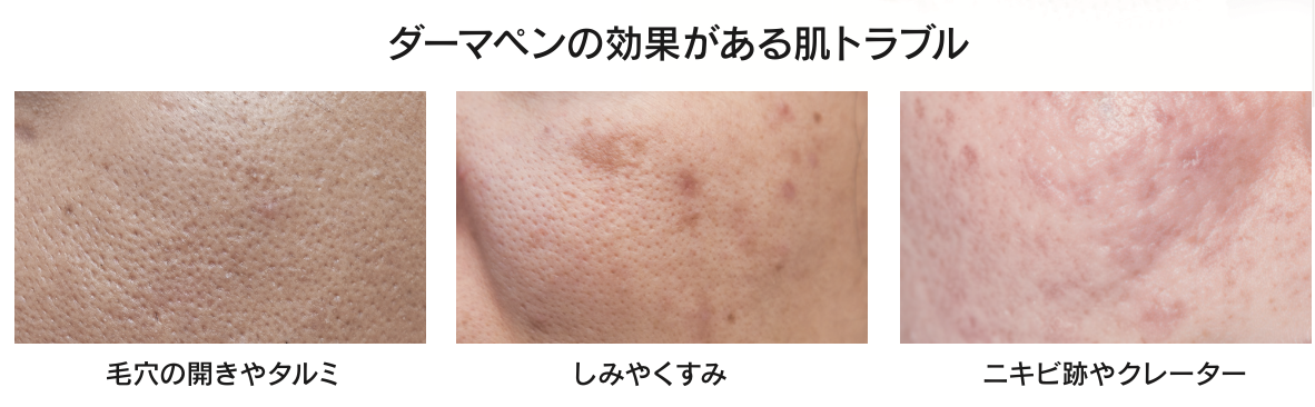 画像に alt 属性が指定されていません。ファイル名: b0771c7376dcbc41e13c76ae8988866d.png